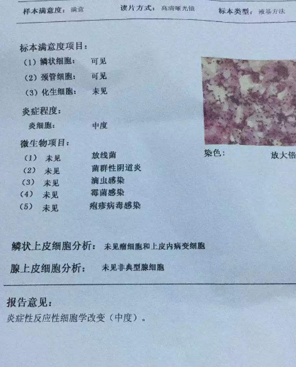 阴道分泌物茄子视频黄色版本下载安装包厂家教你查看阴道分泌物检测报告